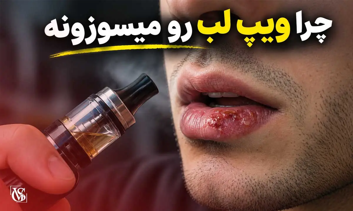 چرا ویپ لب رو میسوزونه